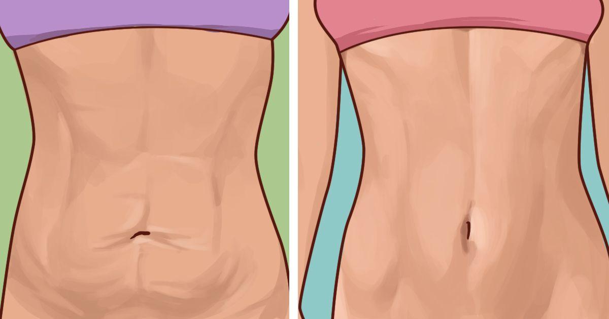 Как самостоятельно подтянуть дряблую кожу после похудения